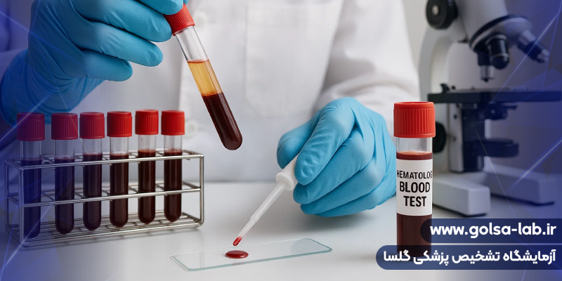 آزمایش هماتولوژی