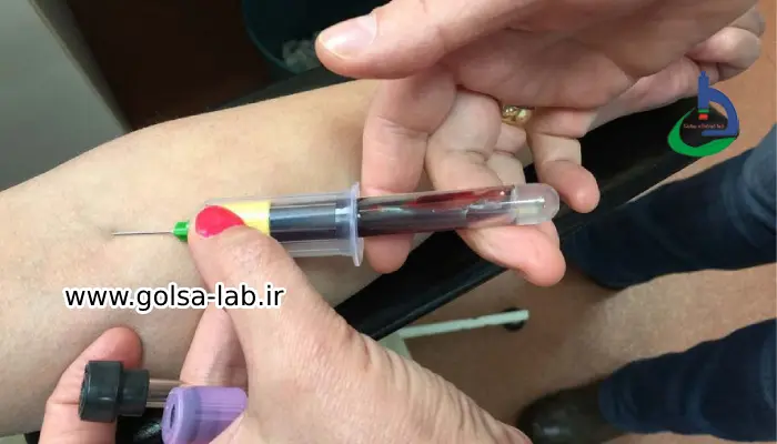 نمونه گیری خون