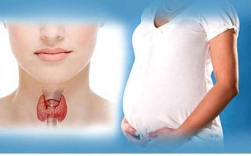 کم کاری تیروئید و حاملگی