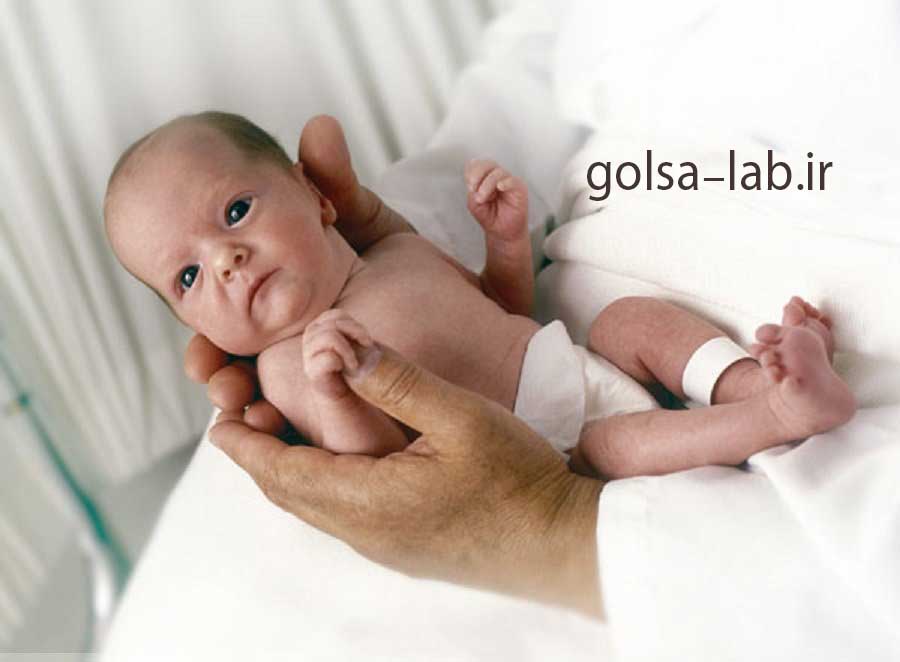 کم کاری تیروئید در نوزادان و کودکان