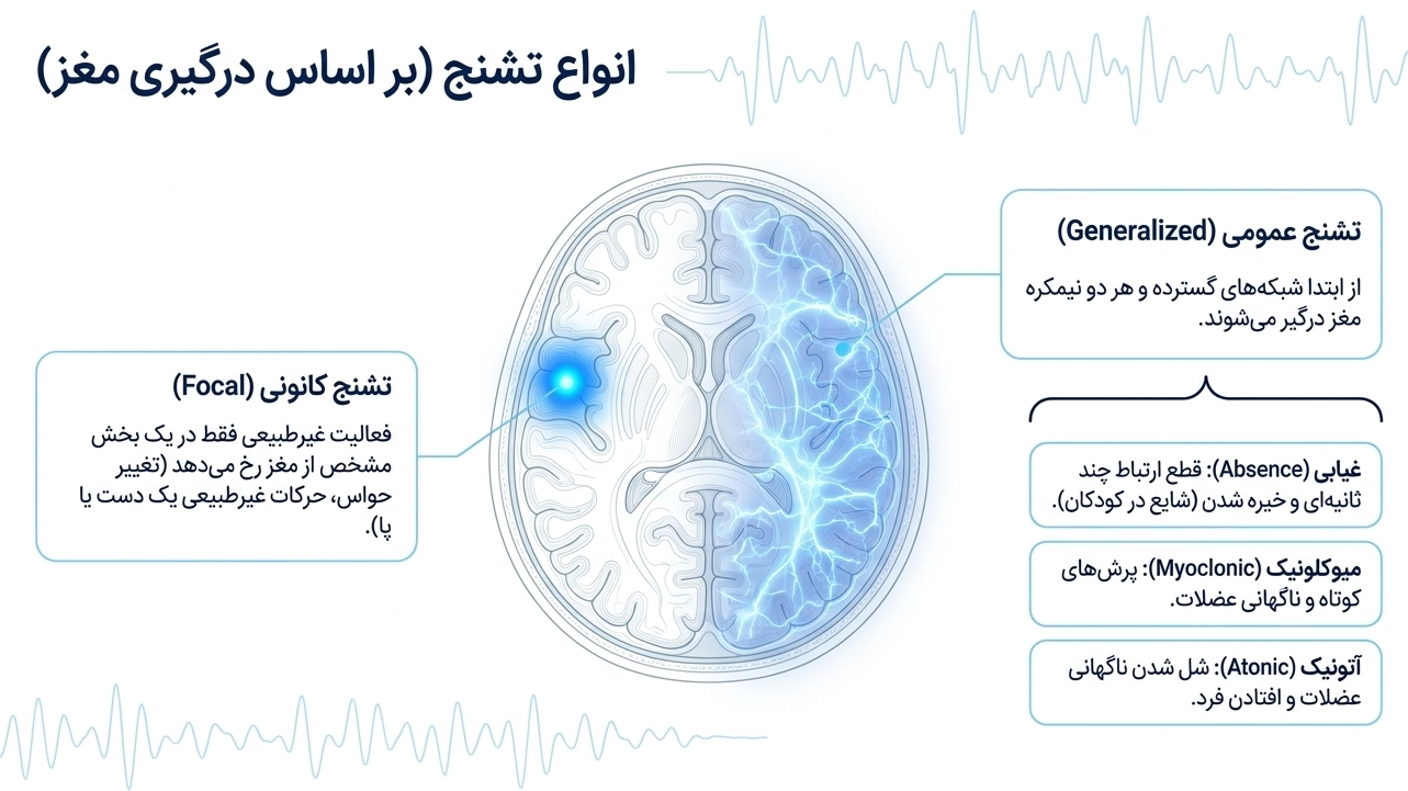 انواع تشنج