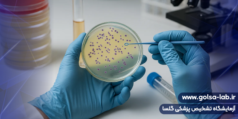 انجام تستهای میکروبی
