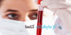 آزمایش خون در محمد شهر