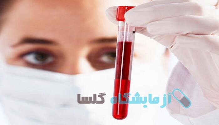 آزمایش خون در محمد شهر