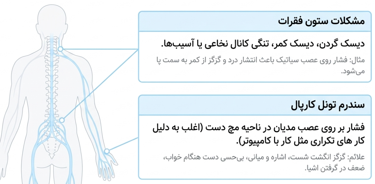 مشکلات ستون فقرات و گیر افتادن عصب و گزگز دست و پا