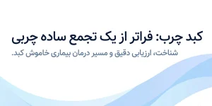 کبد چرب