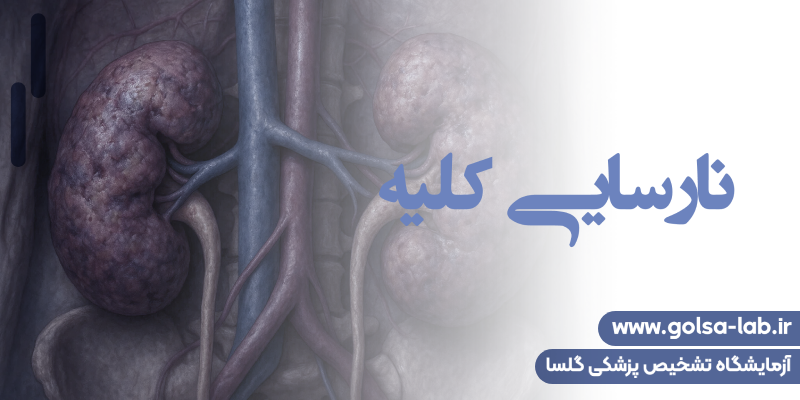 نارسایی کلیه