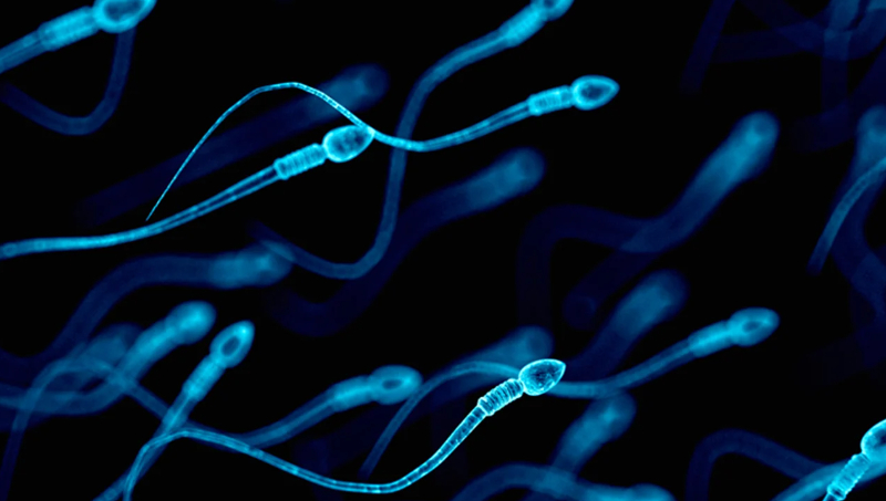 راهنماي بيمار جهت تهيه نمونه مايع مني