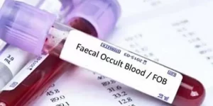آزمايش خون مخفي Occult Blood (OB)