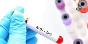 آزمایش هورمون آنتی مولرین(AMH)