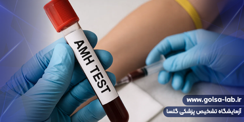 هورمون آنتی مولرین