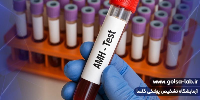 هزینه و محل انجام آزمایش AMH