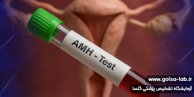 نحوه انجام آزمایش AMH