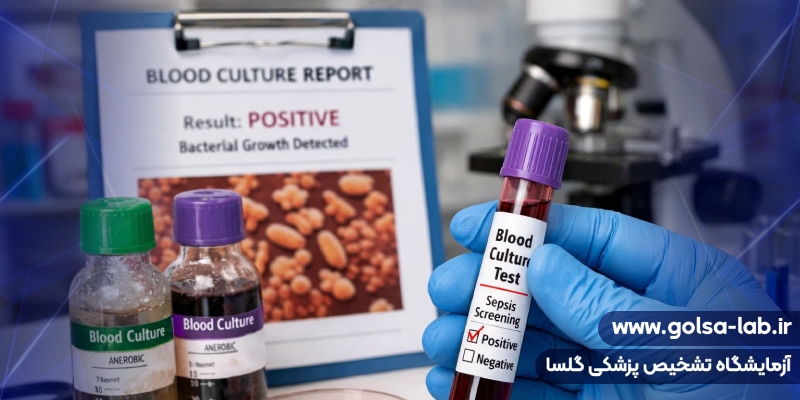 عفونت خون در بارداری