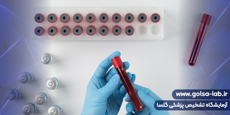 آزمایشهای عفونت خون