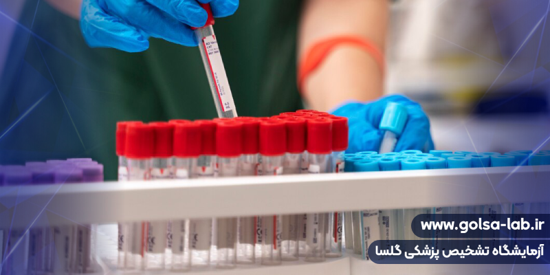 آزمایش اندوتوکسین