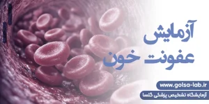 آزمایش عفونت خون