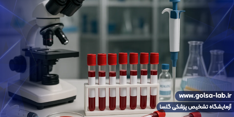 آزمایش خون در کرج