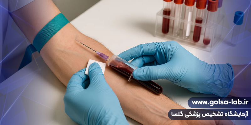 مراحل انجام آزمایش خون